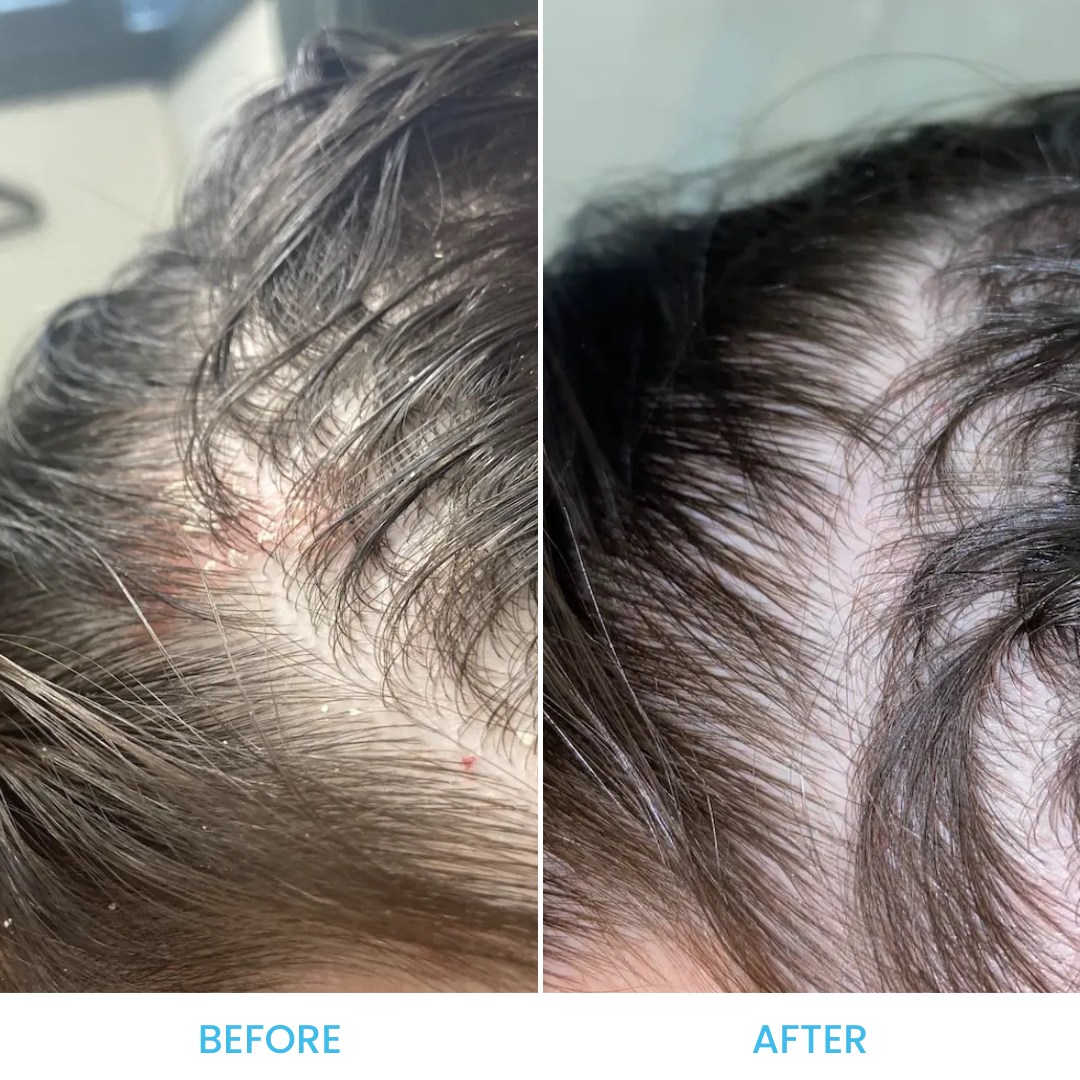 Scalp Relief Shampoo