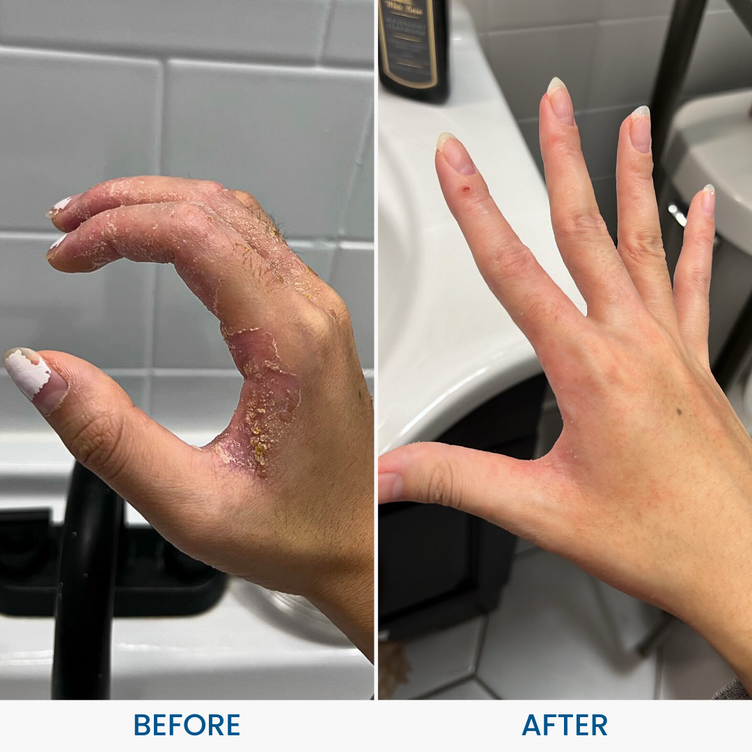 Grahams_Natural_Skin_Therapy_Oil_Hand_Before_After