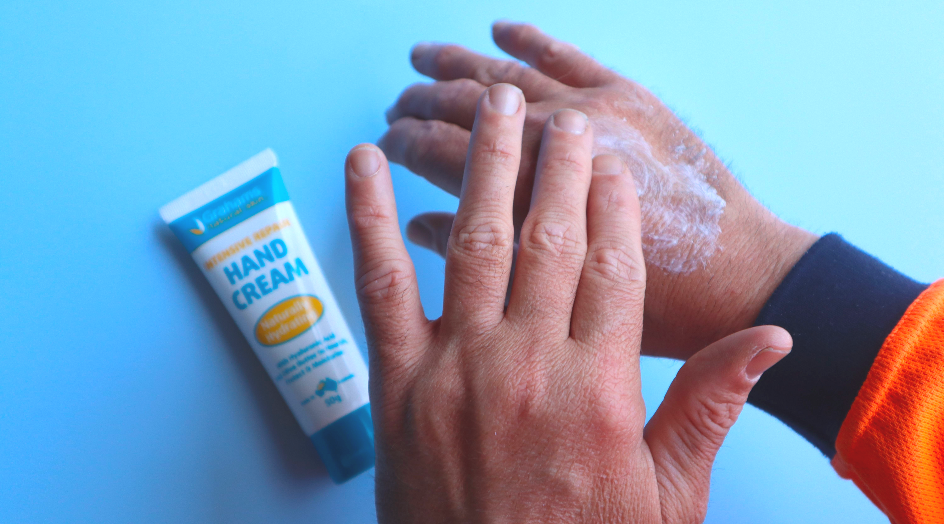 Dry Hands: Causes & Treatment 