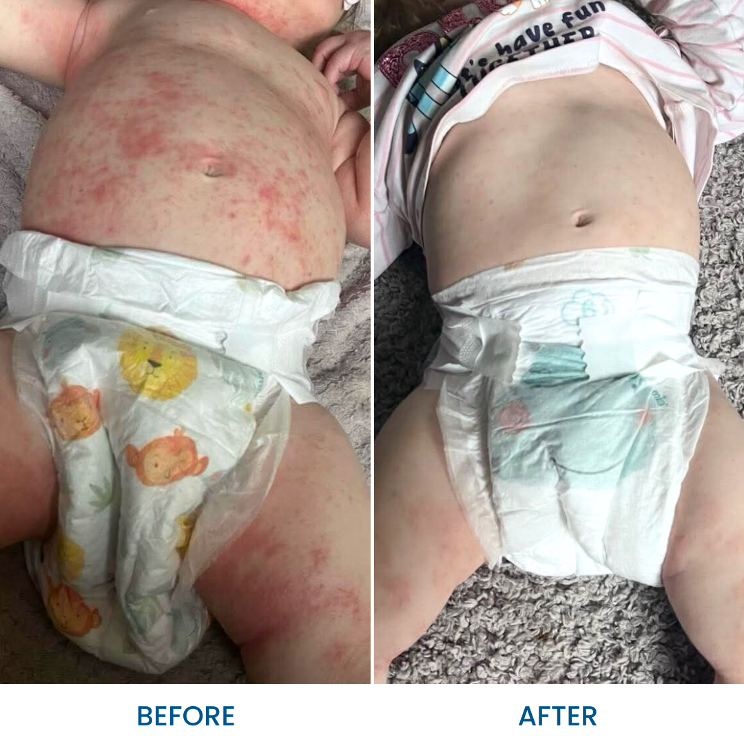 Baby Therapeutic Pack