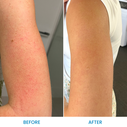 Grahams_Natural_KP_Cream_Before_After_Results