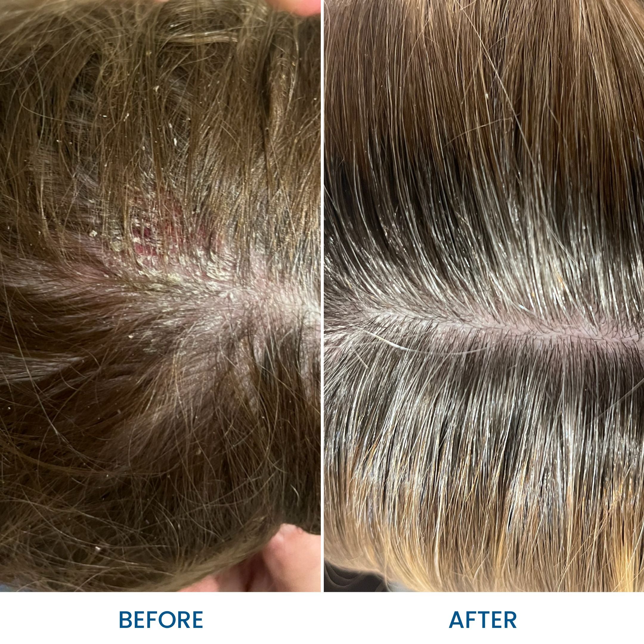 Grahams_Natural_Scalp_Relief_Oil_Before_After_Results
