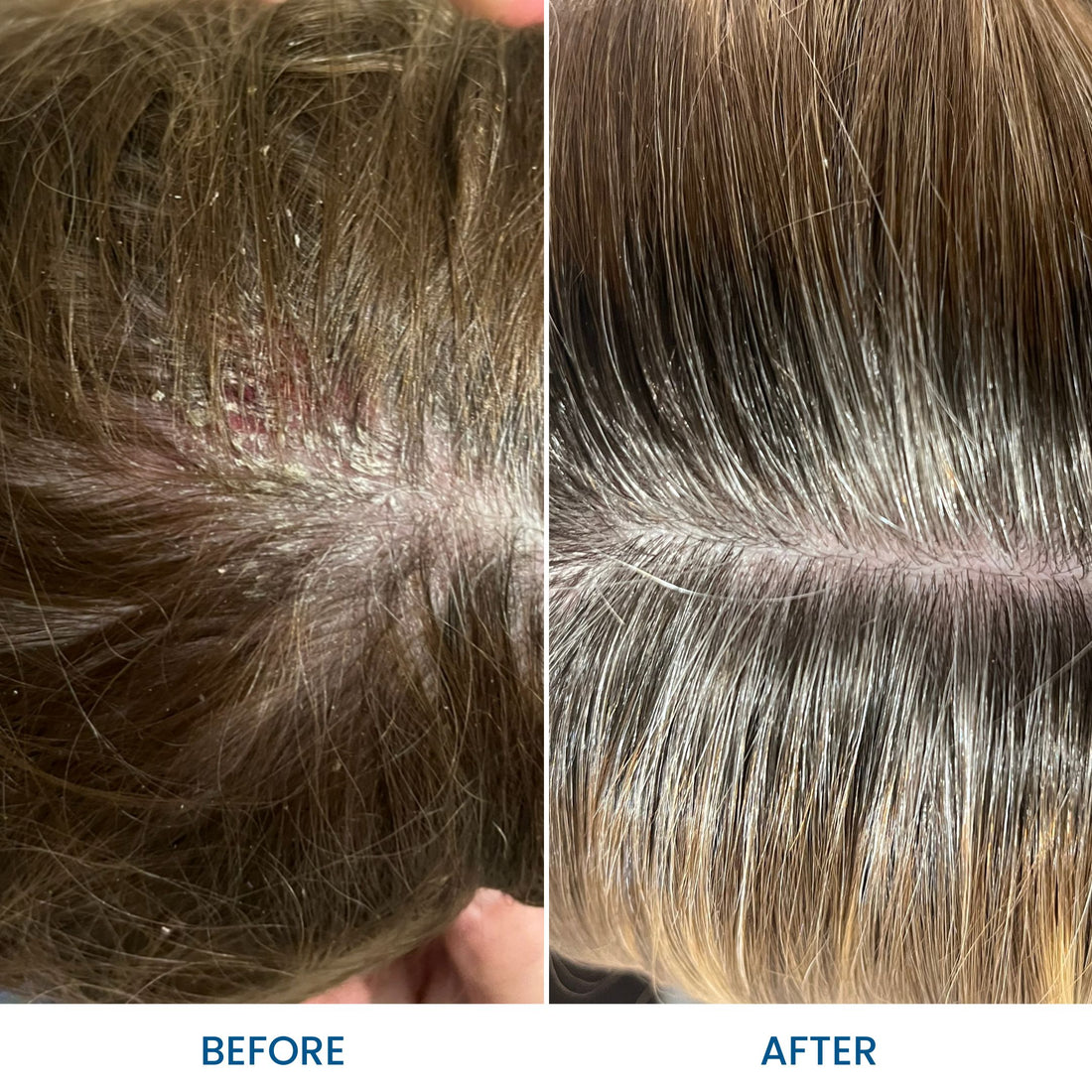 Grahams_Natural_Scalp_Relief_Oil_Before_After_Results