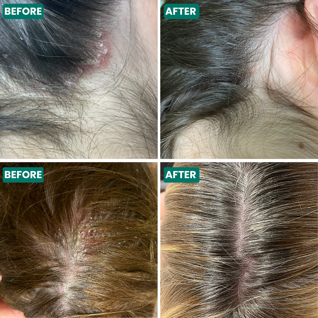 Grahams_Natural_Scalp_Relief_Oil_Scalp_Improvement