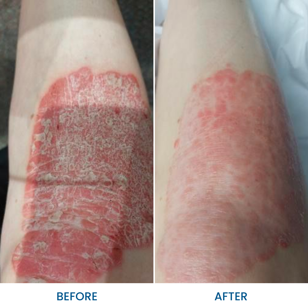 Grahams_Natural_Skin_Therapy_Oil_Before_After_Results