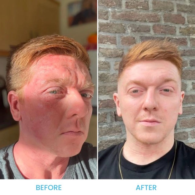 Face & Eyelid Eczema Cream Grahams Natural USA